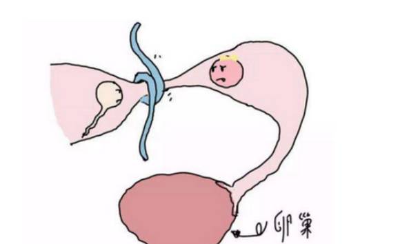 南京助孕机构：流产症状解读，了解血块和孕囊的不同
