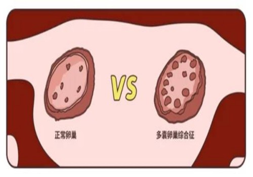 南京试管助孕价格：移植后打着床针有用吗,症状有哪些呢