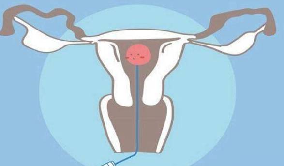 南京助孕机构：取卵后便秘开塞露不能盲目用，小心适得其反