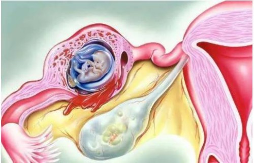 南京助孕中心：HCG检查，怀孕多久可以进行？