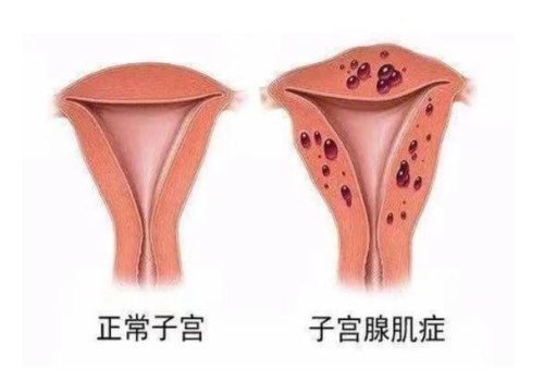 南京试管助孕公司：试管婴儿取卵不打麻药的真实感受，到底疼不疼
