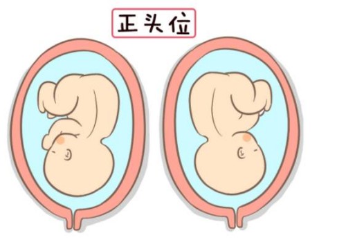南京正规助孕机构：唐筛攻略：孕妇需警惕18-三体综合征致畸的风险！