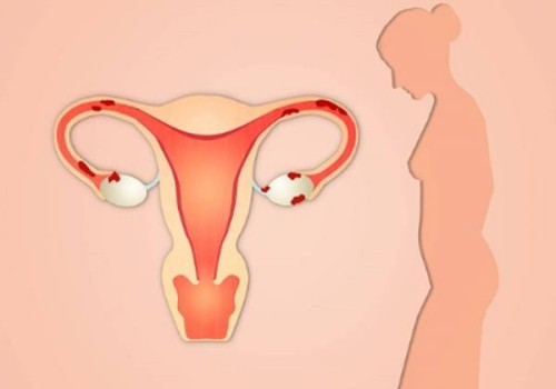 南京助孕机构：孕期乳头流出红色液体怎么办,健康护理要点指南