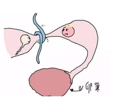 南京三代试管助孕：穿刺取精手术费用包含这些方面，附影响手术费用的四大因素_1